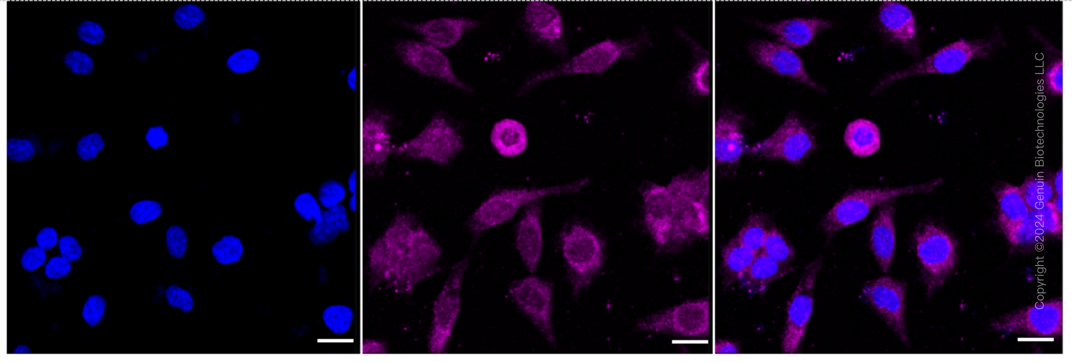 KD-Validated Anti-Retinoic Acid Receptor beta Rabbit Monoclonal Antibody ABG1647