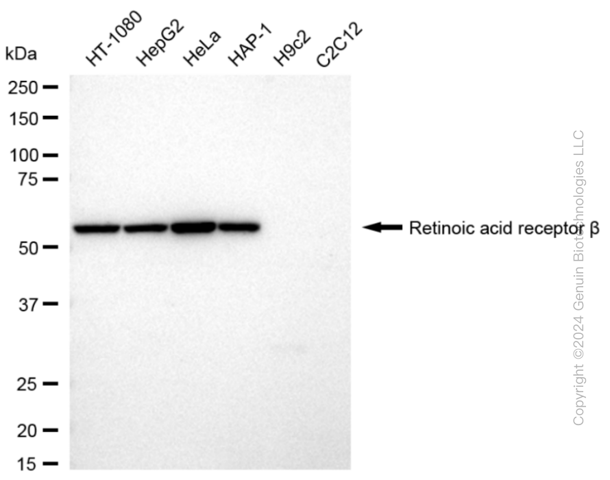 KD-Validated Anti-Retinoic Acid Receptor beta Rabbit Monoclonal Antibody ABG1647