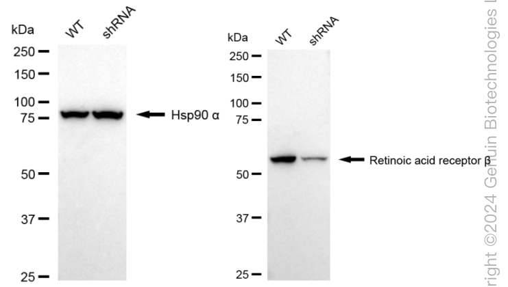 KD-Validated Anti-Retinoic Acid Receptor beta Rabbit Monoclonal Antibody ABG1647