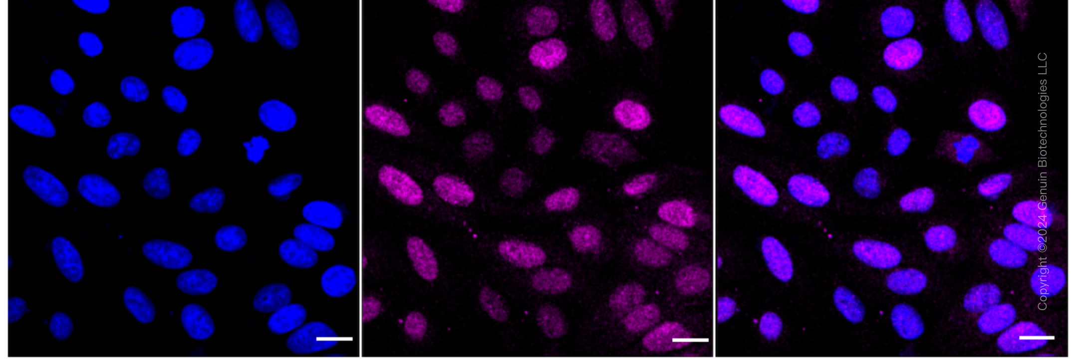 KD-Validated Anti-RAD23A Rabbit Monoclonal Antibody ABG1649
