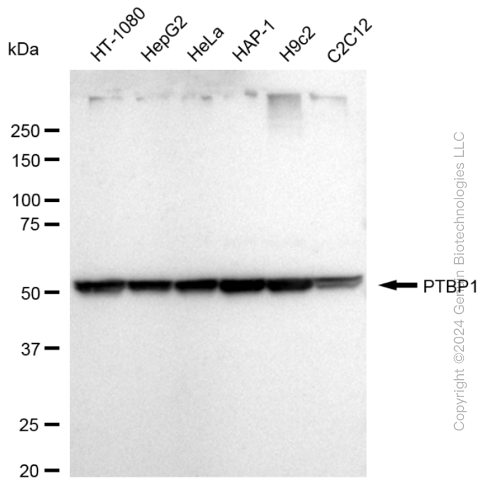 KD-Validated Anti-PTBP1 Rabbit Monoclonal Antibody ABG1652