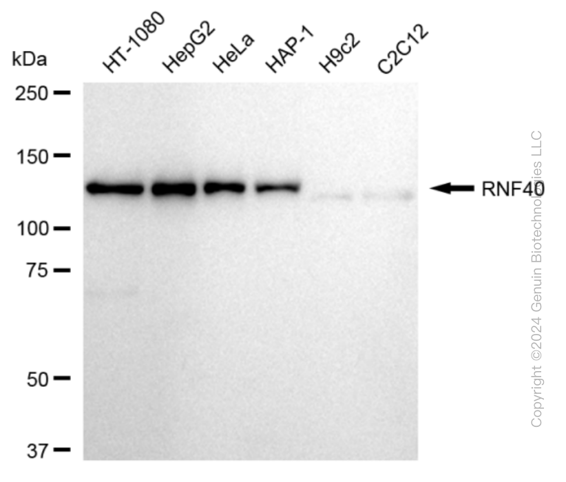 KD-Validated Anti-Ring Finger Protein 40 Rabbit Monoclonal Antibody ABG1653