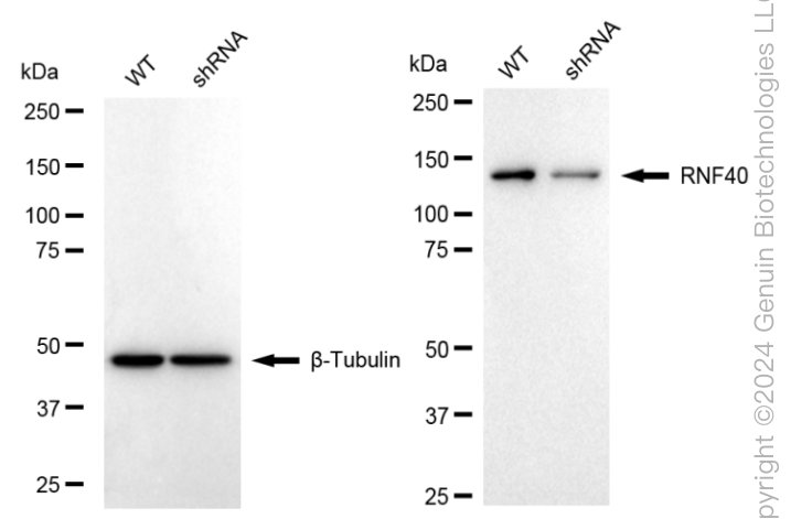 KD-Validated Anti-Ring Finger Protein 40 Rabbit Monoclonal Antibody ABG1653