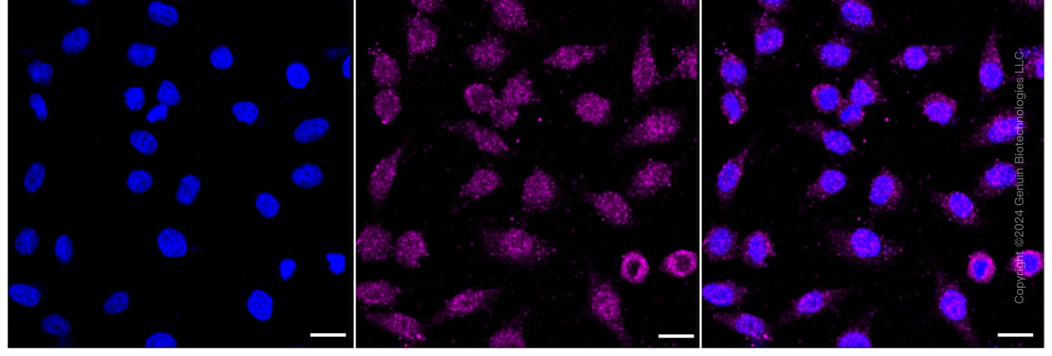 KD-Validated Anti-SAMM50 Rabbit Monoclonal Antibody ABG1654