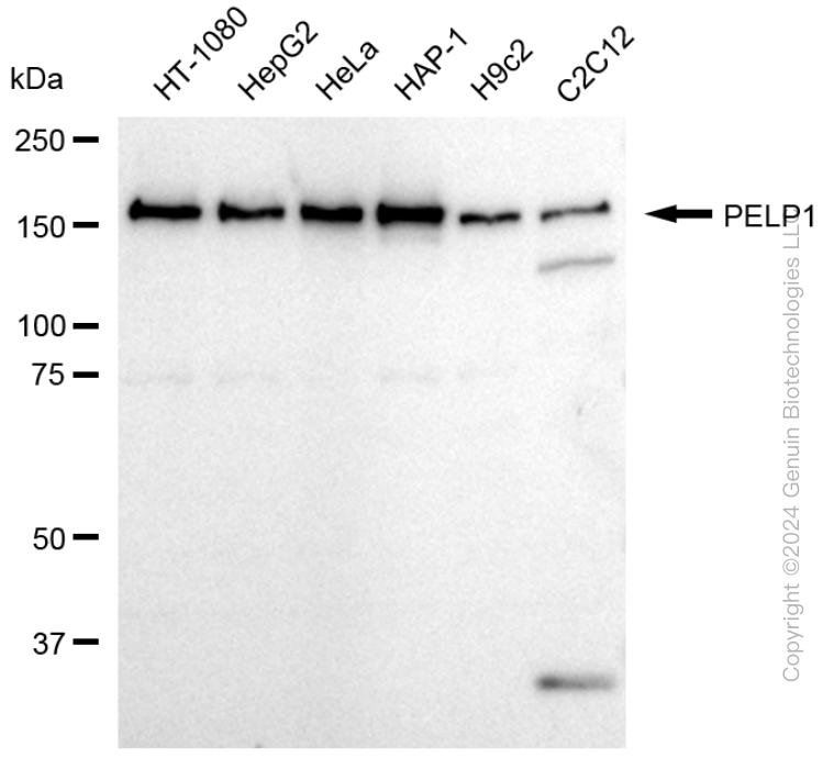KD-Validated Anti-PELP1 Rabbit Monoclonal Antibody ABG1655