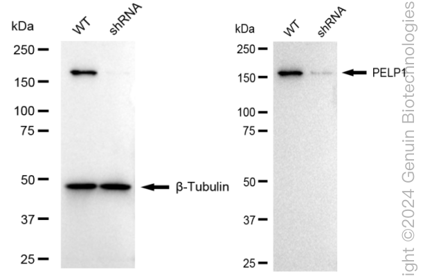 KD-Validated Anti-PELP1 Rabbit Monoclonal Antibody ABG1655