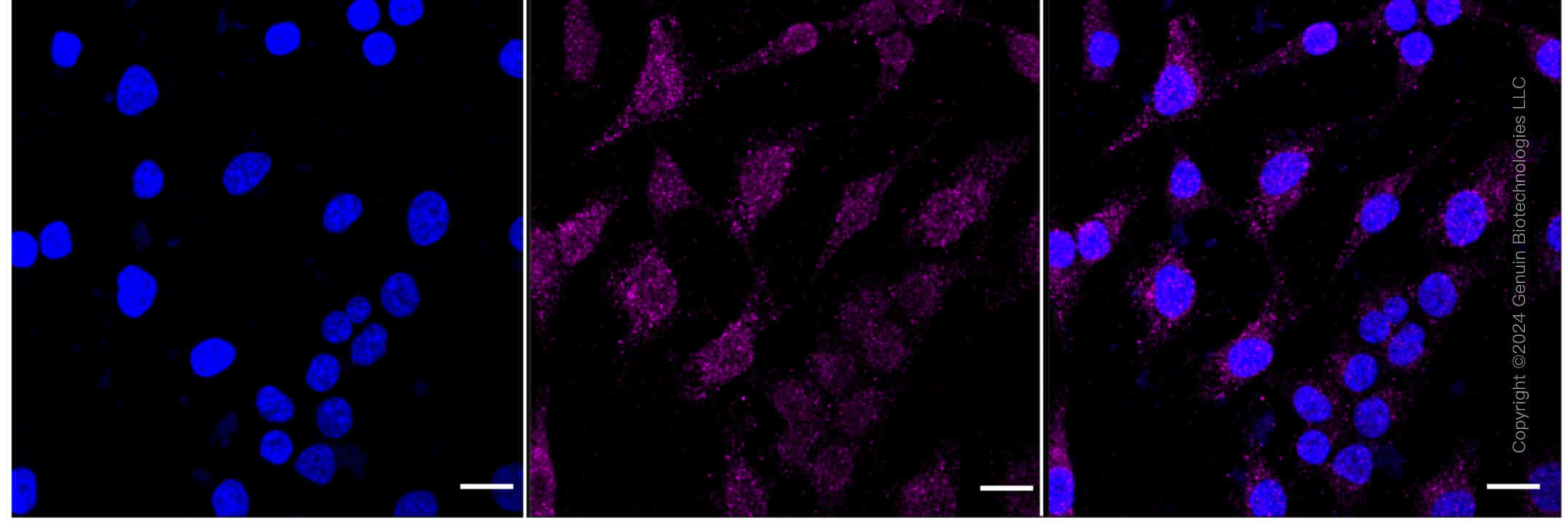 KD-Validated Anti-PIK3C3 Rabbit Monoclonal Antibody ABG1656