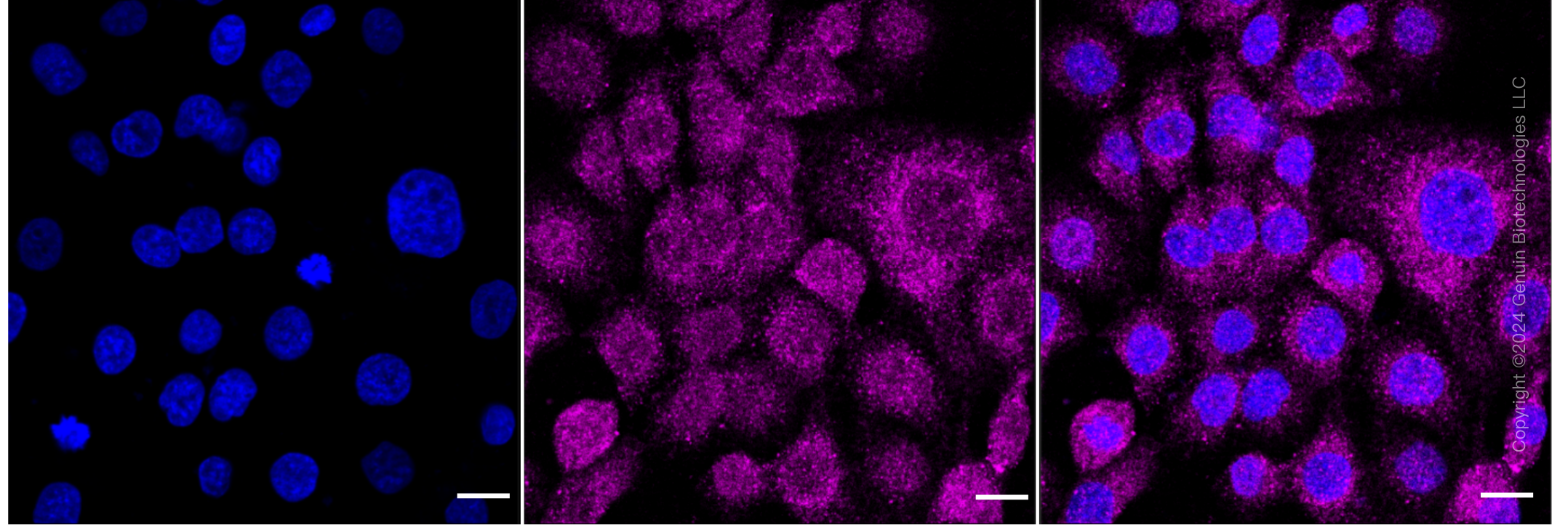 KD-Validated Anti-Retinoic Acid Receptor Alpha Rabbit Monoclonal Antibody ABG1657