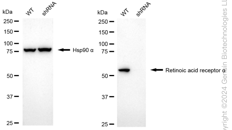 KD-Validated Anti-Retinoic Acid Receptor Alpha Rabbit Monoclonal Antibody ABG1657