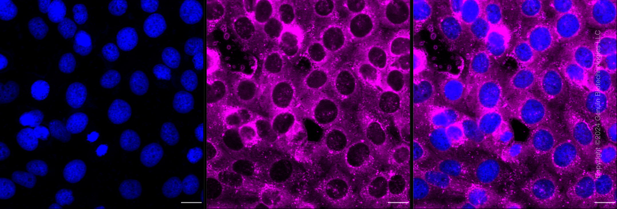 KD-Validated Anti-Fibronectin 1 Rabbit Monoclonal Antibody ABG1658
