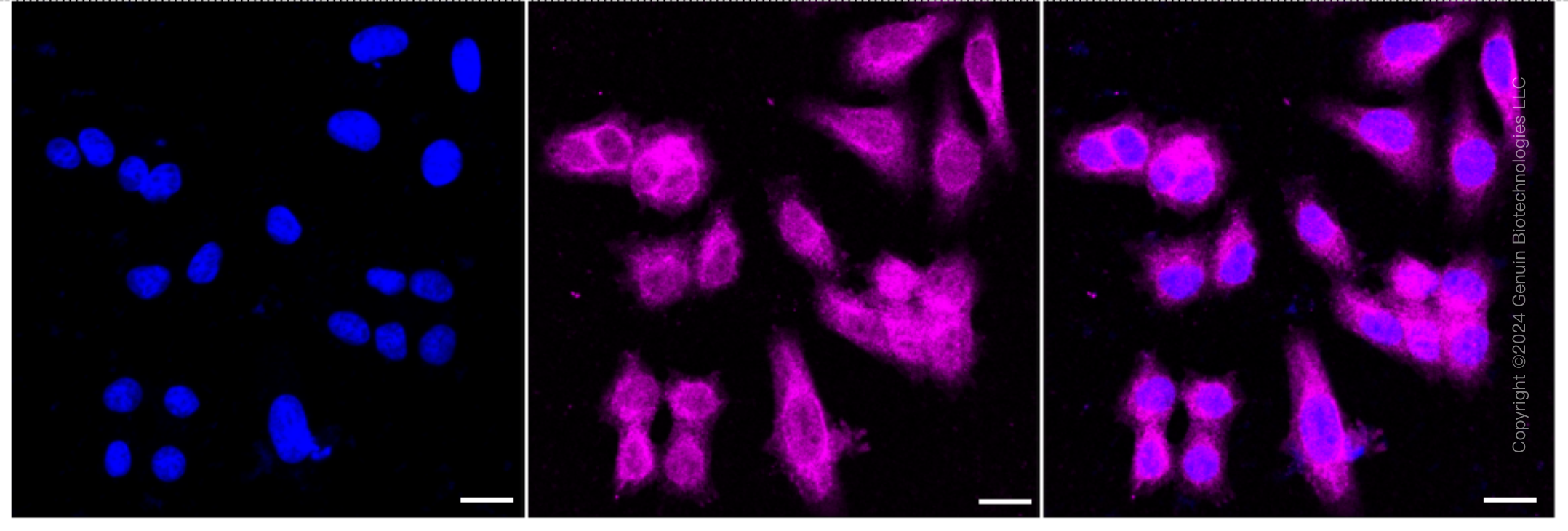 KD-Validated Anti-PPP2R5E Rabbit Monoclonal Antibody ABG1661