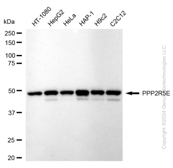 KD-Validated Anti-PPP2R5E Rabbit Monoclonal Antibody ABG1661