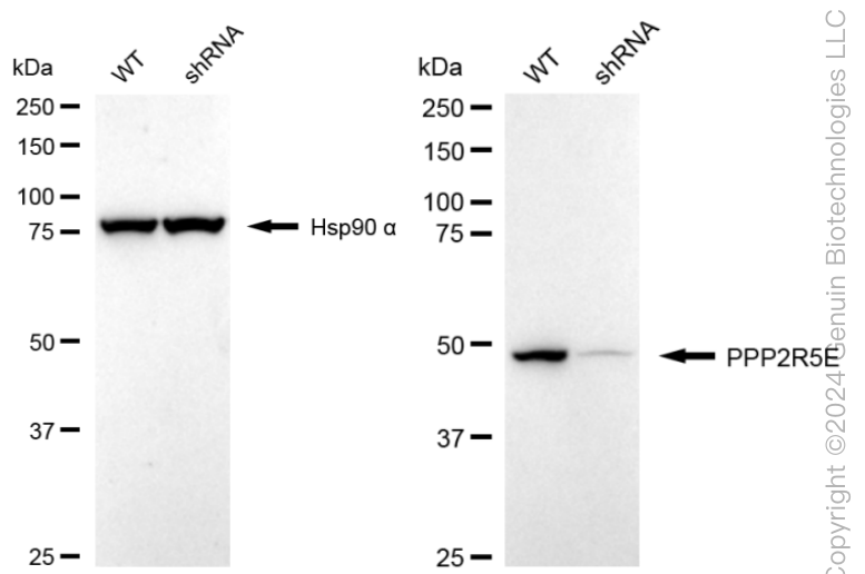 KD-Validated Anti-PPP2R5E Rabbit Monoclonal Antibody ABG1661