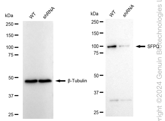 KD-Validated Anti-SFPQ Rabbit Monoclonal Antibody ABG1662