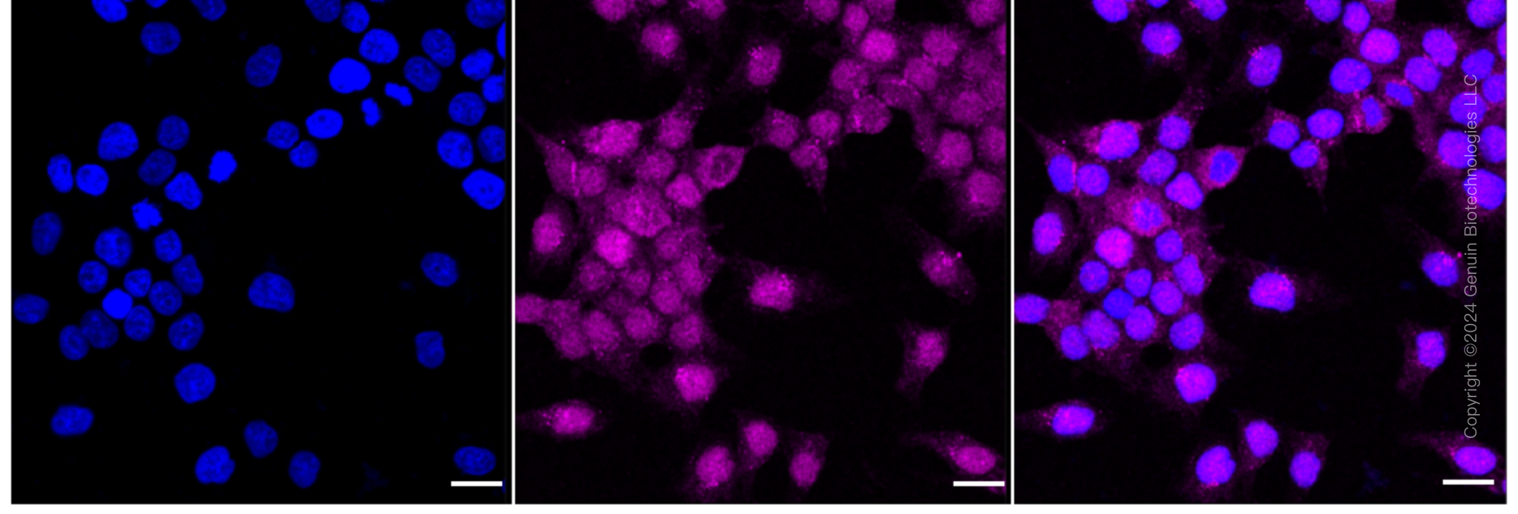 KD-Validated Anti-Ribosomal Protein S6 Kinase B2 Rabbit Monoclonal Antibody ABG1663