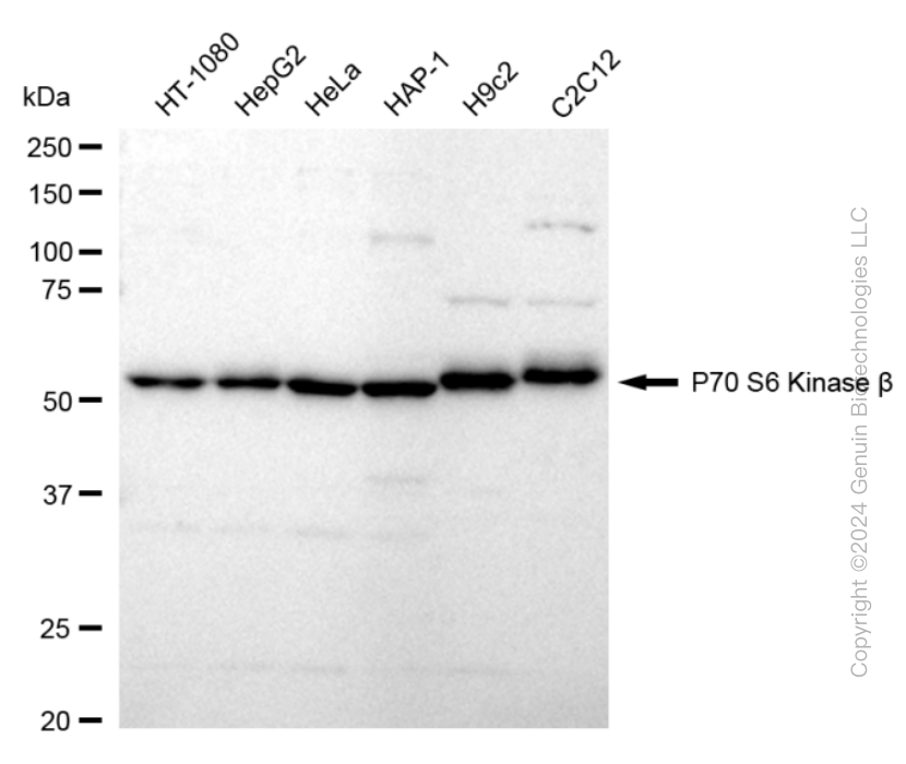 KD-Validated Anti-Ribosomal Protein S6 Kinase B2 Rabbit Monoclonal Antibody ABG1663