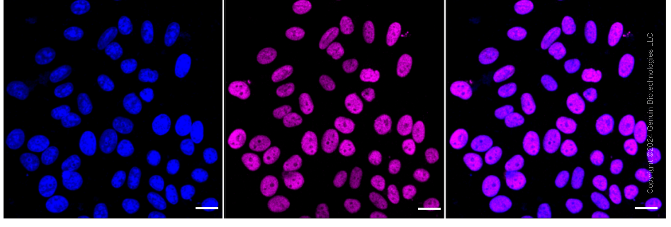 KD-Validated Anti-RBBP4 Rabbit Monoclonal Antibody ABG1664