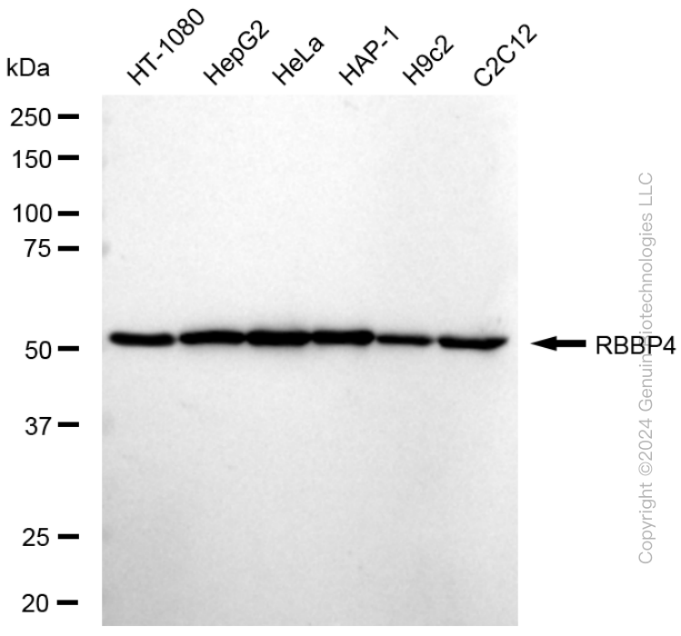 KD-Validated Anti-RBBP4 Rabbit Monoclonal Antibody ABG1664