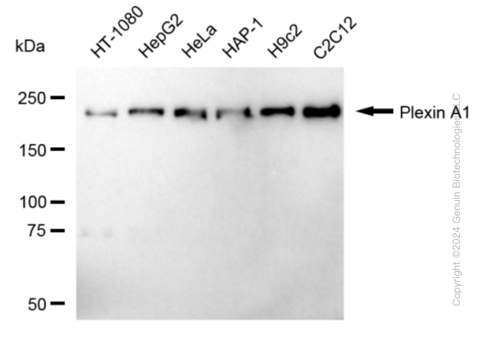KD-Validated Anti-Plexin A1 Rabbit Monoclonal Antibody ABG1665