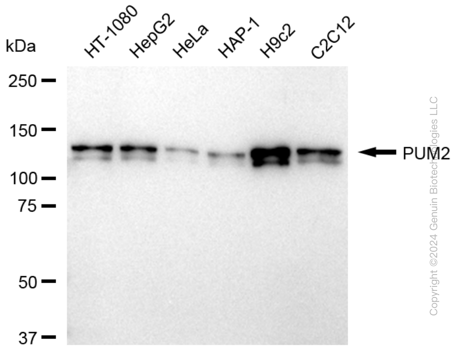 KD-Validated Anti-PUM2 Rabbit Monoclonal Antibody ABG1666