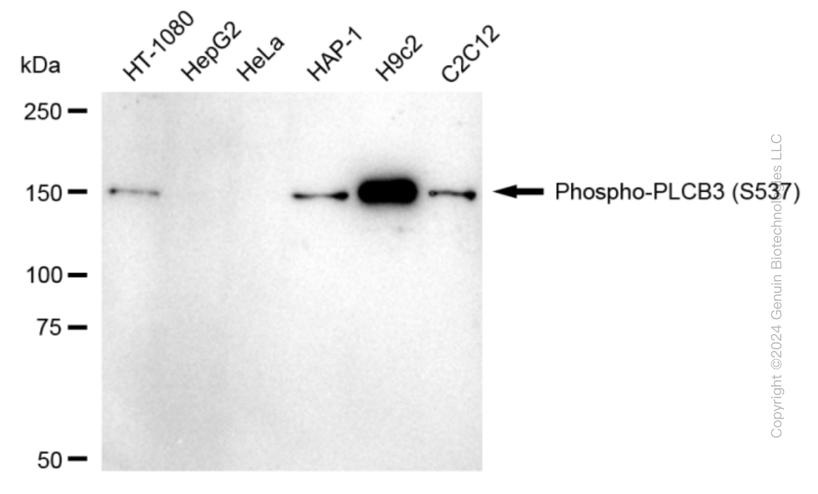 KD-Validated Anti-Phospho-PLCB3 (S537) Rabbit Monoclonal Antibody ABG1667