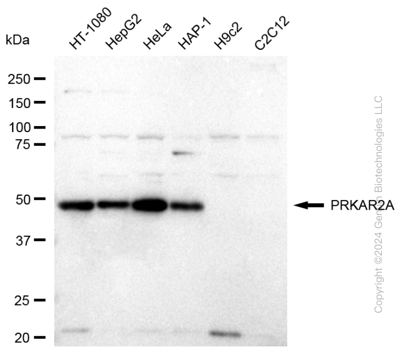 KD-Validated Anti-PRKAR2A Rabbit Monoclonal Antibody ABG1668