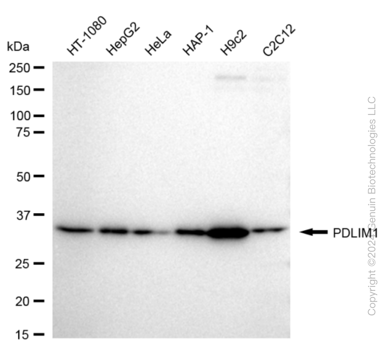 KD-Validated Anti-PDZ And LIM Domain 1 Rabbit Monoclonal Antibody ABG1672