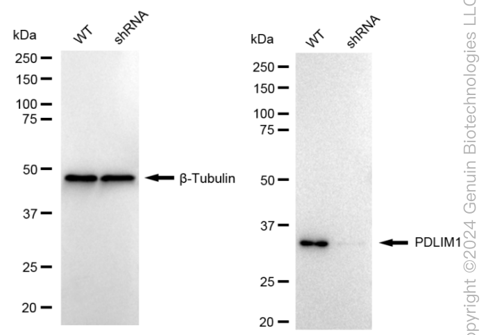 KD-Validated Anti-PDZ And LIM Domain 1 Rabbit Monoclonal Antibody ABG1672