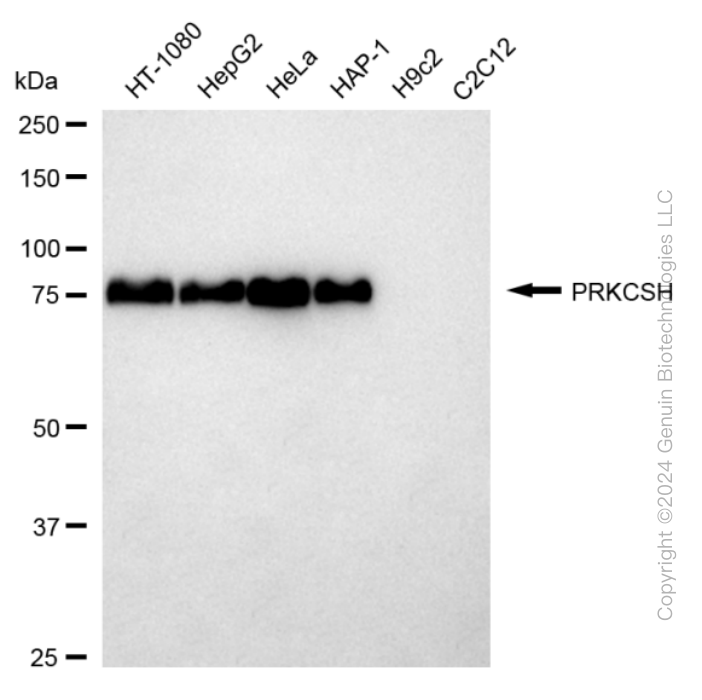 KD-Validated Anti-PRKCSH Rabbit Monoclonal Antibody ABG1673
