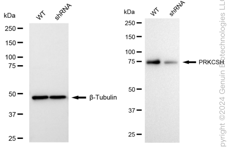 KD-Validated Anti-PRKCSH Rabbit Monoclonal Antibody ABG1673