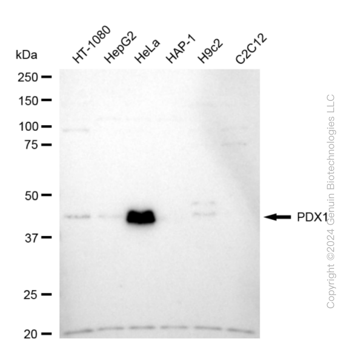 KD-Validated Anti-Pancreatic And Duodenal Homeobox 1 Rabbit Monoclonal Antibody ABG1677