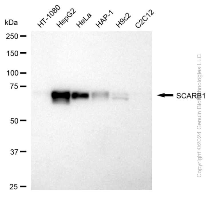 KD-Validated Anti-SCARB1 Rabbit Monoclonal Antibody ABG1679
