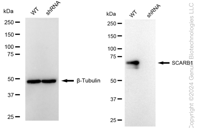 KD-Validated Anti-SCARB1 Rabbit Monoclonal Antibody ABG1679