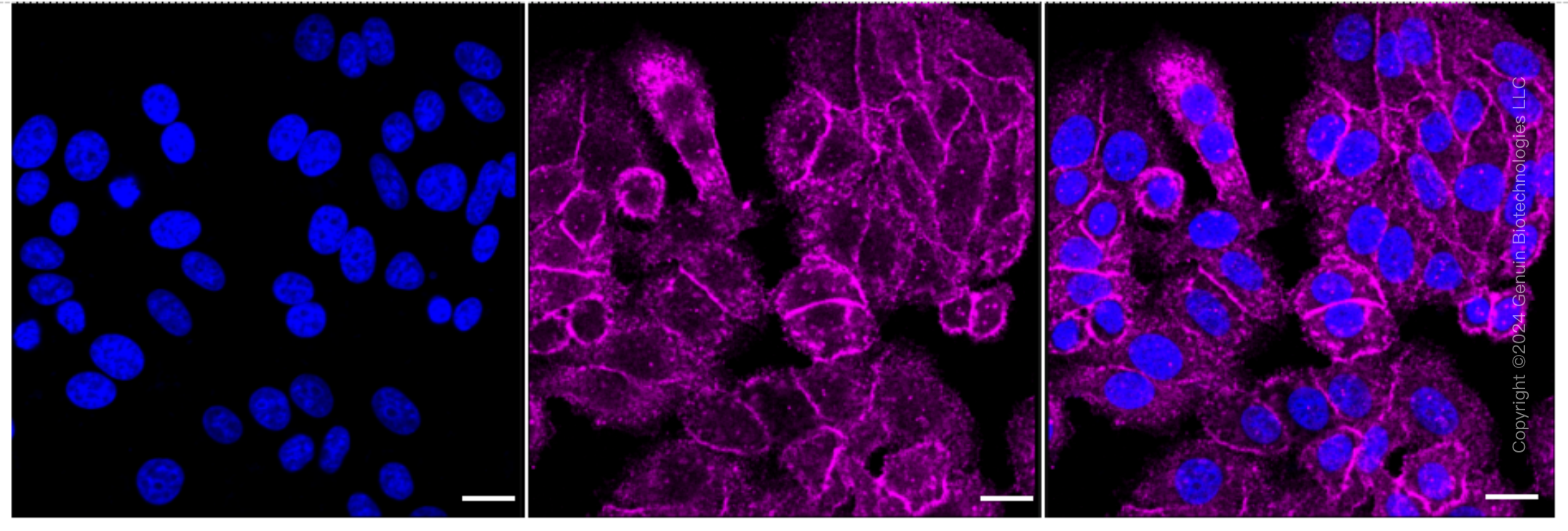 KD-Validated Anti-Radixin Rabbit Monoclonal Antibody ABG1680