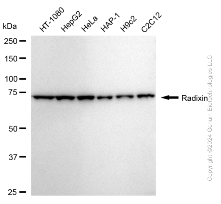 KD-Validated Anti-Radixin Rabbit Monoclonal Antibody ABG1680