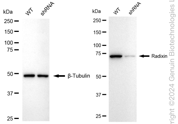 KD-Validated Anti-Radixin Rabbit Monoclonal Antibody ABG1680