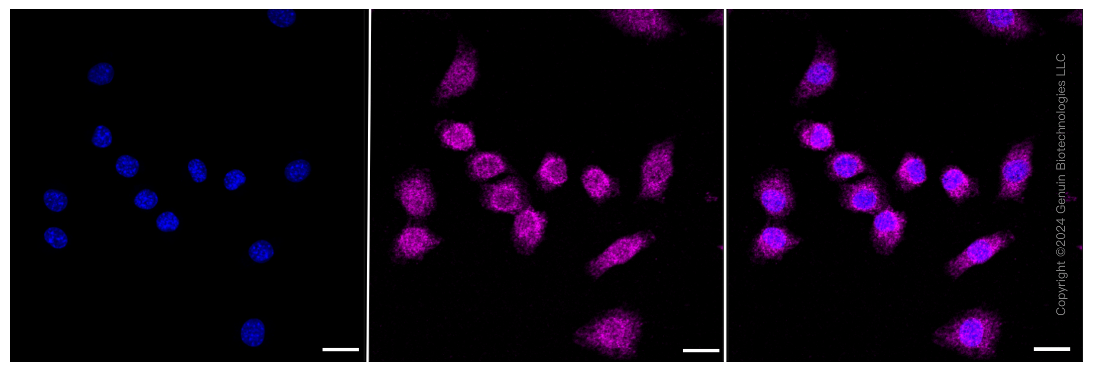 KD-Validated Anti-FOXO1 Rabbit Monoclonal Antibody ABG1684