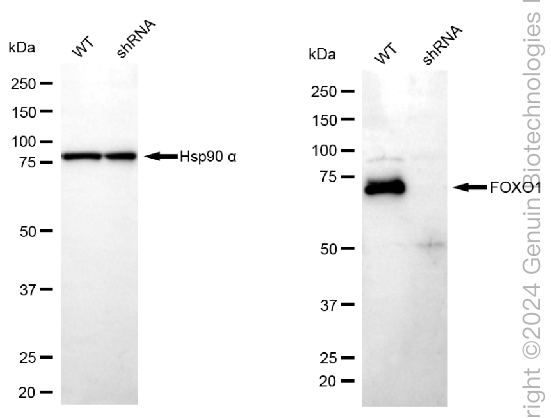 KD-Validated Anti-FOXO1 Rabbit Monoclonal Antibody ABG1684