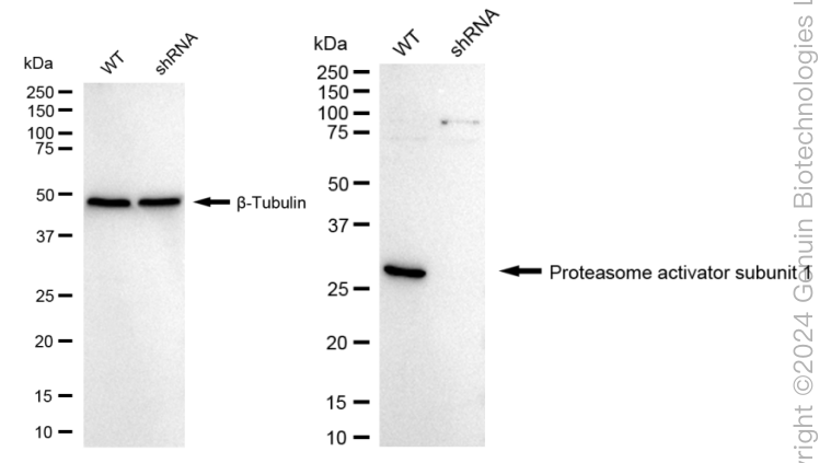 KD-Validated Anti-Proteasome Activator Subunit 1 Rabbit Monoclonal Antibody ABG1685