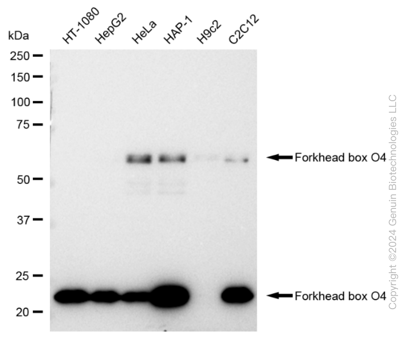 KD-Validated Anti-Forkhead box O4 Rabbit Monoclonal Antibody ABG1686