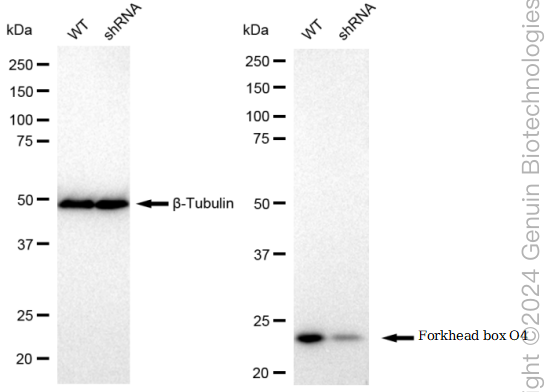 KD-Validated Anti-Forkhead box O4 Rabbit Monoclonal Antibody ABG1686
