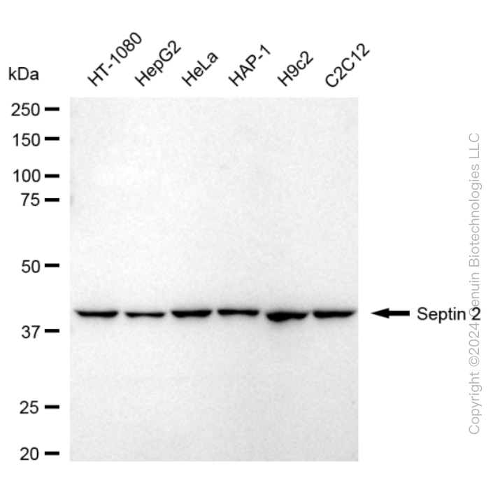KD-Validated Anti-Septin 2 Rabbit Monoclonal Antibody ABG1688