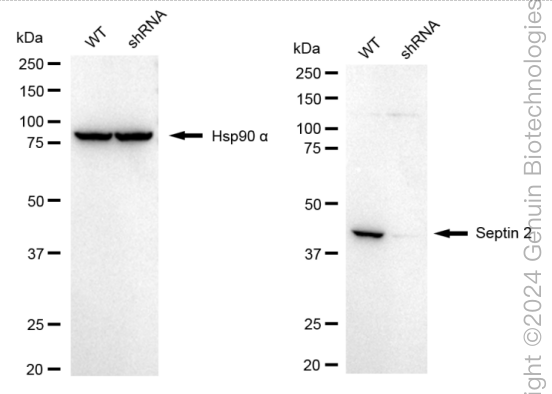 KD-Validated Anti-Septin 2 Rabbit Monoclonal Antibody ABG1688