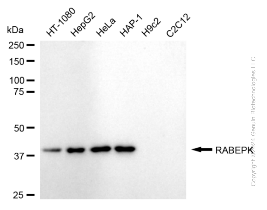 KD-Validated Anti-RABEPK Rabbit Monoclonal Antibody ABG1689