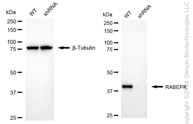 KD-Validated Anti-RABEPK Rabbit Monoclonal Antibody ABG1689