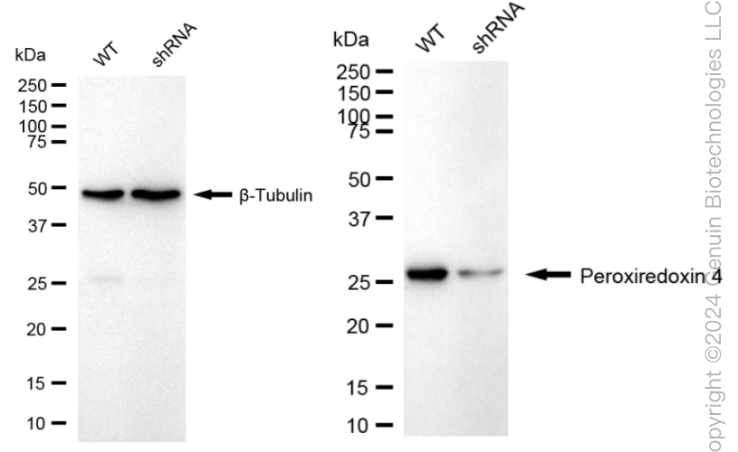 KD-Validated Anti-Peroxiredoxin 4 Rabbit Monoclonal Antibody ABG1693