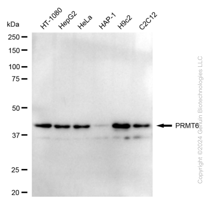 KD-Validated Anti-PRMT6 Rabbit Monoclonal Antibody ABG1694