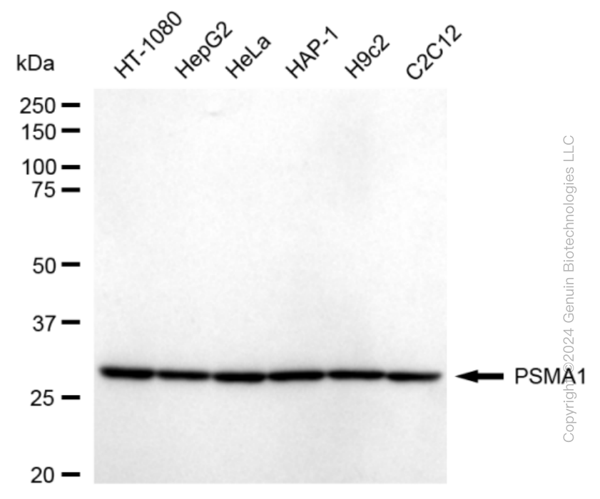 KD-Validated Anti-PSMA1 Rabbit Monoclonal Antibody ABG1695
