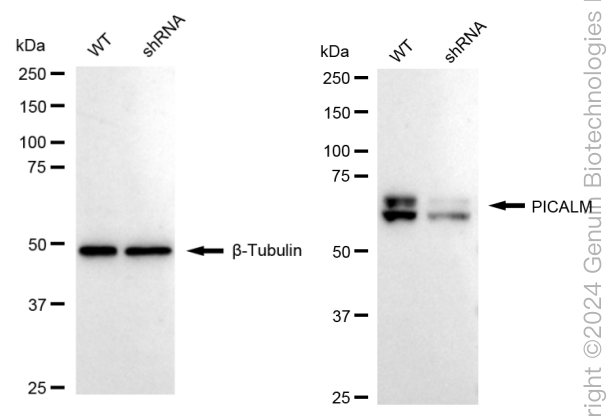 KD-Validated Anti-PICALM Rabbit Monoclonal Antibody ABG1696
