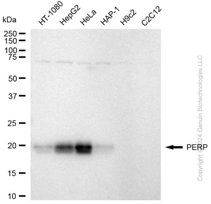 KD-Validated Anti-PERP Rabbit Monoclonal Antibody ABG1697